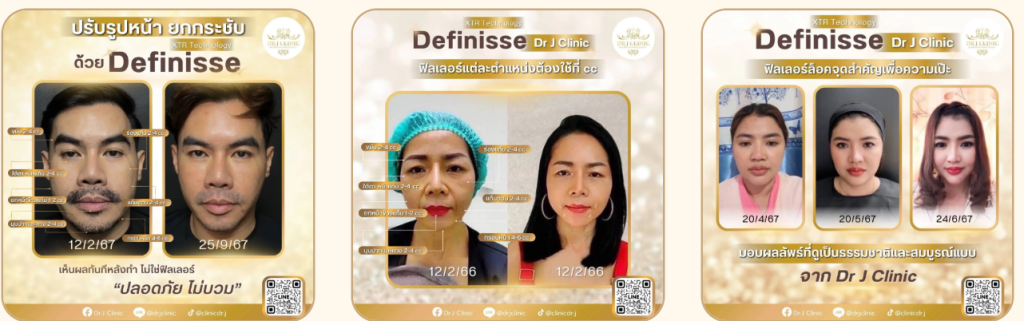 Juvelook หน้าเงาใส